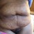 This is my stomach on week pre op.