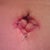 bb @ 3 weeks po. I think it looks awesome! can't wait to get those last few stitches out.