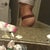 18 DAYS POST OP