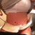 Day 2 PO. I'm really swollen. My incision is pretty low, which is nice. It feels weird without my binder on, I like the security of it, even though it is uncomfortable.