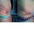 Left side day 10 right side day 21