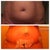Before/ after 7 day P/O