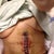 1day post op. feeling good!