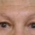 ta eyes before facelift.jpg