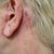 ta neck scars.JPG