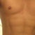 Four weeks post surgery. Went to the beach for the first time today and felt good although slightly paranoid that the scars were still so noticeable. Can't wait for them to fade so I can confidently take my top off. Dr. Lanzer did a great job creating a natural looking result - just like I asked him to do.