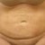 Front view - two weeks.