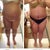 Here is my "before" and "3 days po" photos. I'm really swollen, so hopefully this will look a lot better when I'm completely healed.