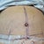 This is my tummy 1 day po.