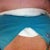 Day of surgery