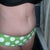 14 weeks 2 days PO