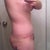 8 weeks- still swollen