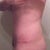 8 weeks-stil swollen