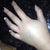 my hand after surgery...was gonna explode...it was nuts