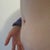 this is the area that's bothering me. I figure the squishiness is to be expected with how thin that skin was but the hard lump underneath is pushing the bulge out further on the one side.