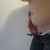 hoping this resolves on its own before the 6 month mark. it's something I would be willing to undergo a (hopefully minor) revision for if it doesn't. I don't need perfection but I do want 'flattish' and no weird hard bits.