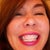 Smiling like an Opossum with my first Ceramic Braces done in my late 40's.