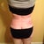 Post Op Day 33 - back
