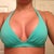 1 month post op! can't wait until swimsuit season.