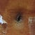 Sooo gross !! That's the scan in my belly button. The stitches are dissolvable...