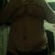 13 days post op naked