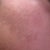 See the new skin coming out after the black layer is gone? It's beautiful~!~! Now I just have to make sure I keep it that way. :P