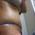 one week post op