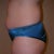 Ugh - Muffin top - Day before surgery