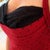 After Breast Augmentation