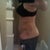5 days post op without garment. I am so swollen still. I don't see much of a difference.