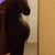 side view salama 3 weeks post op