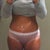 Post op day 10 

I'm not sure if I'm happy with the belly button...Too small?? Too narrow?? IDK, my sister says it's a good shape and size maybe I just need to relax LOL