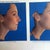 Before and After Imaging done by Dr. Cochran. Looks pretty identical to me!