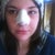 2 day post op. Sans Mustache.