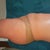 6 weeks side sorry, forgot to turn it upright