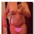 PO Day 5 - You can really see the swelling on the non-drain side and the sides of my breasts.