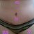 6 weeks post op