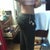 6 days post-op w/o garment