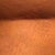 Other side still swollen.