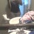 Front view, wearing garment takin on 2/26/2013 (1 day post op), day after surjery, there is some swelling.