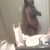 Side View without Garment takin on 2/26/2013 (1 day post op), bleeding has stopped, just swelling and pain still.
