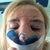 An hour after surgery. PAIN!
