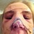 My nose is a mess