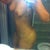5 days post op