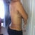 5 day post op