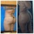 Post op surgery 1 and post op surgery 2