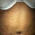 10 day post op still swollen