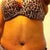 4wks post op