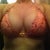 9 days after sugery