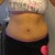 3.5 weeks post-op